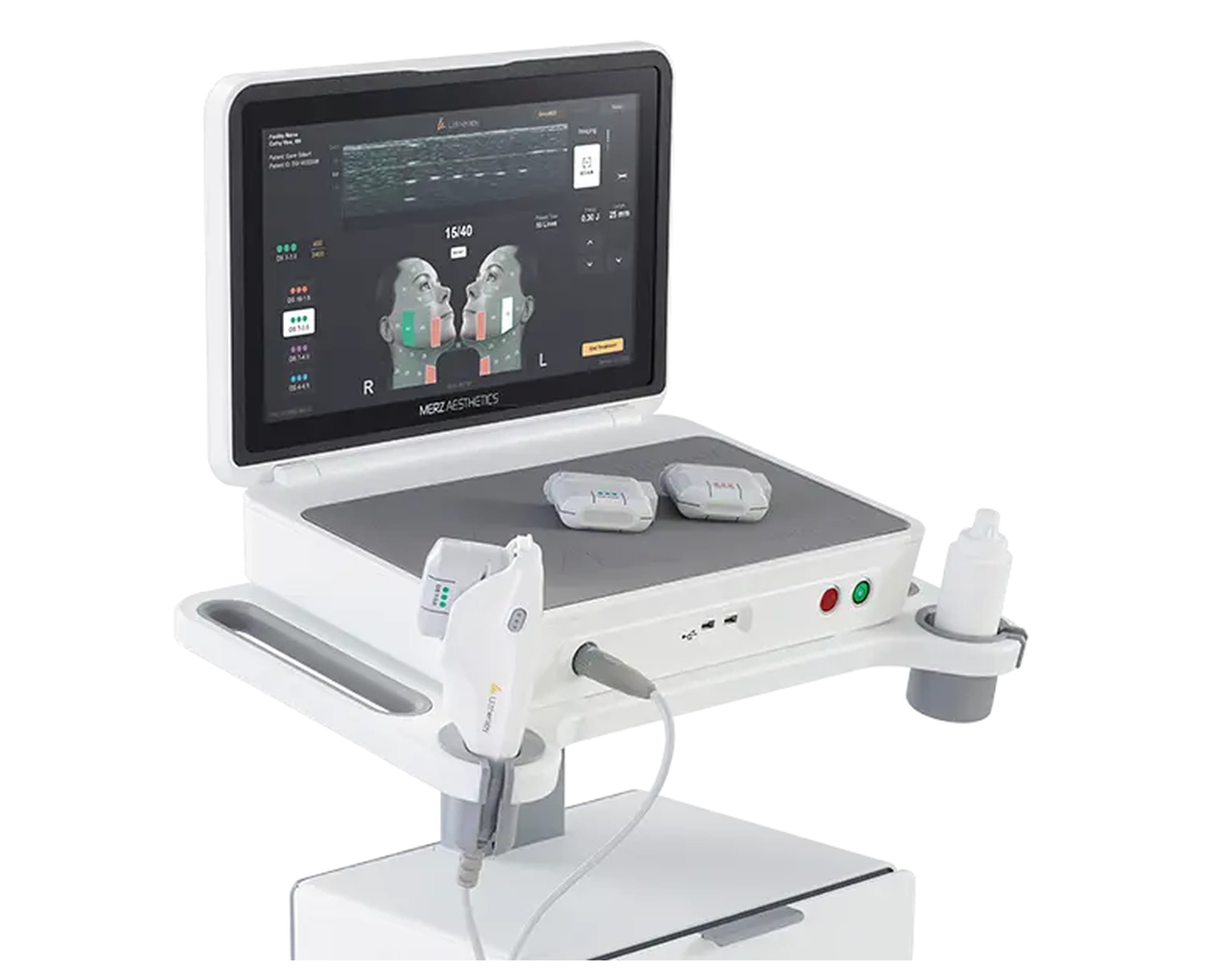 The Ultherapy Prime console, with the control screen showing treatment areas and depths